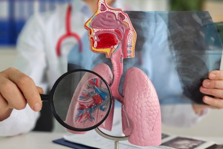 cancer-du-poumon-3-questions-pour-mieux-le-comprendre