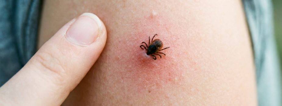 Saison des tiques