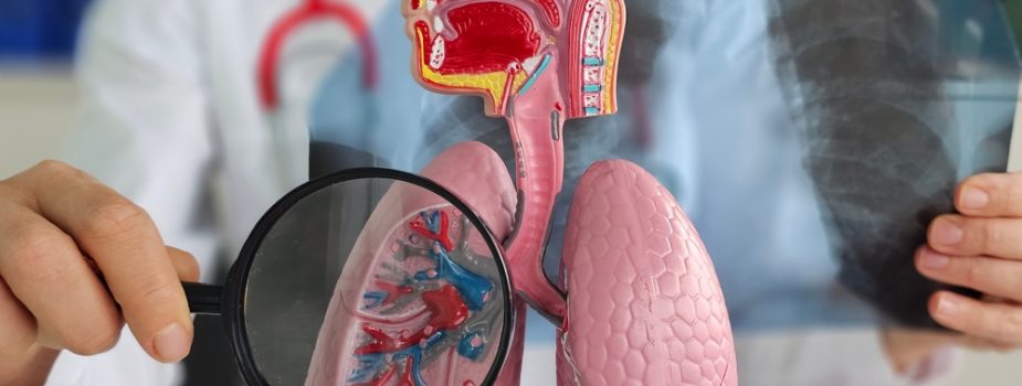 cancer-du-poumon-3-questions-pour-mieux-le-comprendre